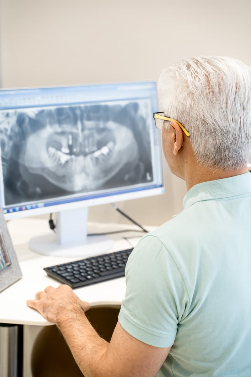 Tannimplantatbehandling ved Perio Tannklinikken - nøyaktig implantatplassering for varige resultater
